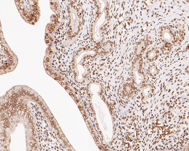 Immunohistochemical analysis of paraffin-embedded rat womb tissue using anti-LMO2 antibody. The section was pre-treated using heat mediated antigen retrieval with sodium citrate buffer (pH 6.0) for 20 minutes. The tissues were blocked in 5% BSA for 30 minutes at room temperature, washed with ddH2O and PBS, and then probed with the primary antibody (ER2001-08, 1/200)  for 30 minutes at room temperature. The detection was performed using an HRP conjugated compact polymer system. DAB was used as the chromogen. Tissues were counterstained with hematoxylin and mounted with DPX.