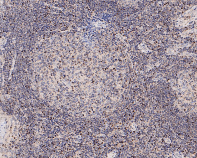 Immunohistochemical analysis of paraffin-embedded human tonsil tissue using anti-LMO2 antibody. The section was pre-treated using heat mediated antigen retrieval with sodium citrate buffer (pH 6.0) for 20 minutes. The tissues were blocked in 5% BSA for 30 minutes at room temperature, washed with ddH2O and PBS, and then probed with the primary antibody (ER2001-08, 1/200)  for 30 minutes at room temperature. The detection was performed using an HRP conjugated compact polymer system. DAB was used as the chromogen. Tissues were counterstained with hematoxylin and mounted with DPX.