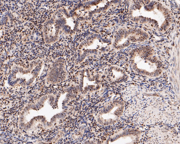 Immunohistochemical analysis of paraffin-embedded human womb tissue using anti-LMO2 antibody. The section was pre-treated using heat mediated antigen retrieval with sodium citrate buffer (pH 6.0) for 20 minutes. The tissues were blocked in 5% BSA for 30 minutes at room temperature, washed with ddH2O and PBS, and then probed with the primary antibody (ER2001-08, 1/200)  for 30 minutes at room temperature. The detection was performed using an HRP conjugated compact polymer system. DAB was used as the chromogen. Tissues were counterstained with hematoxylin and mounted with DPX.