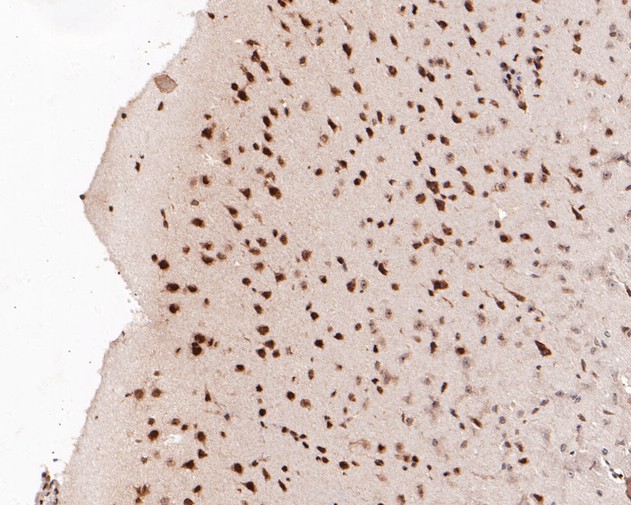Immunohistochemical analysis of paraffin-embedded mouse brain tissue using anti-LMO2 antibody. The section was pre-treated using heat mediated antigen retrieval with sodium citrate buffer (pH 6.0) for 20 minutes. The tissues were blocked in 5% BSA for 30 minutes at room temperature, washed with ddH2O and PBS, and then probed with the primary antibody (ER2001-08, 1/200)  for 30 minutes at room temperature. The detection was performed using an HRP conjugated compact polymer system. DAB was used as the chromogen. Tissues were counterstained with hematoxylin and mounted with DPX.