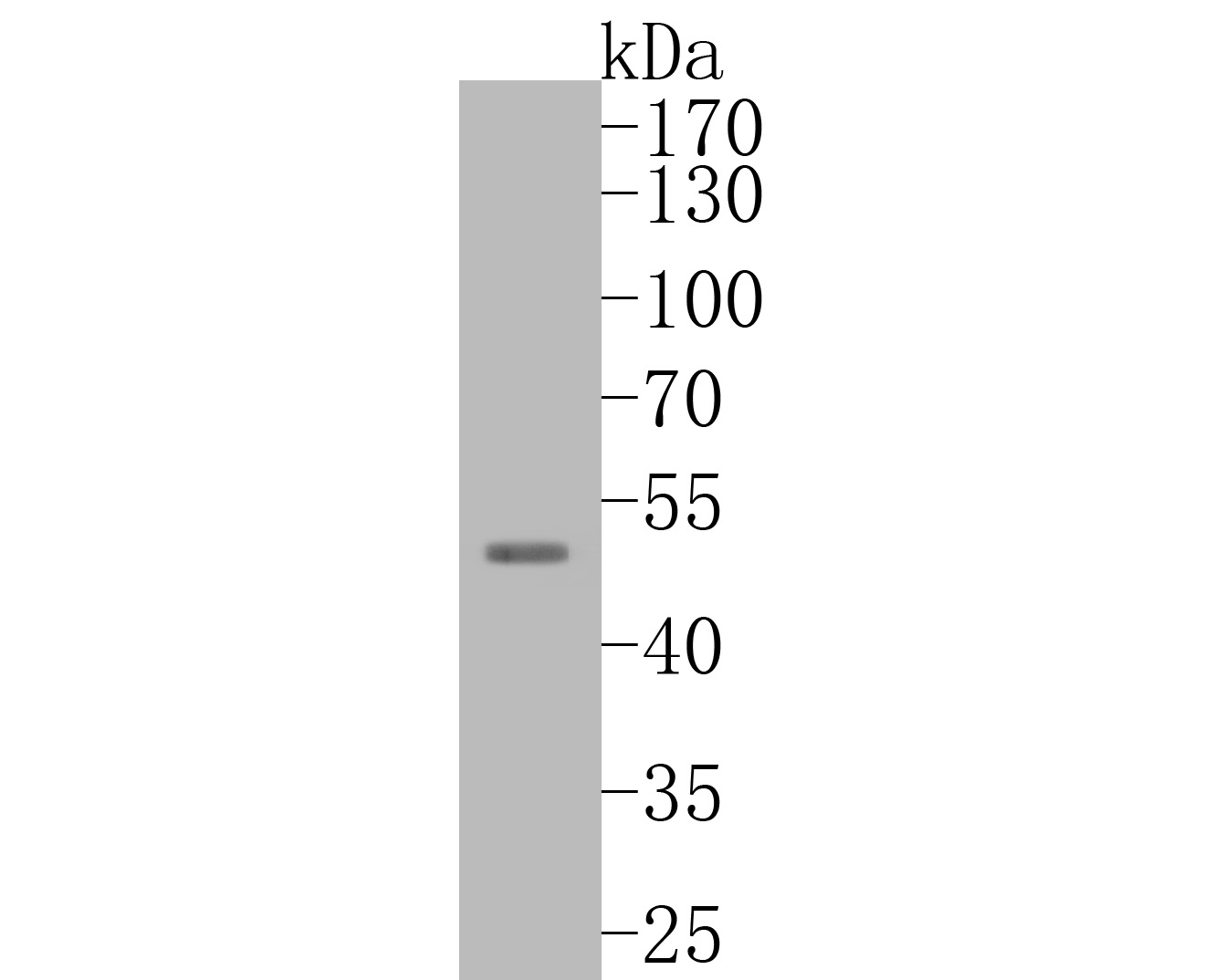 Western blot analysis of TTL on human heart tissue lysates. Proteins were transferred to a PVDF membrane and blocked with 5% BSA in PBS for 1 hour at room temperature. The primary antibody (ER2001-11, 1/500) was used in 5% BSA at room temperature for 2 hours. Goat Anti-Rabbit IgG - HRP Secondary Antibody (HA1001) at 1:5,000 dilution was used for 1 hour at room temperature.