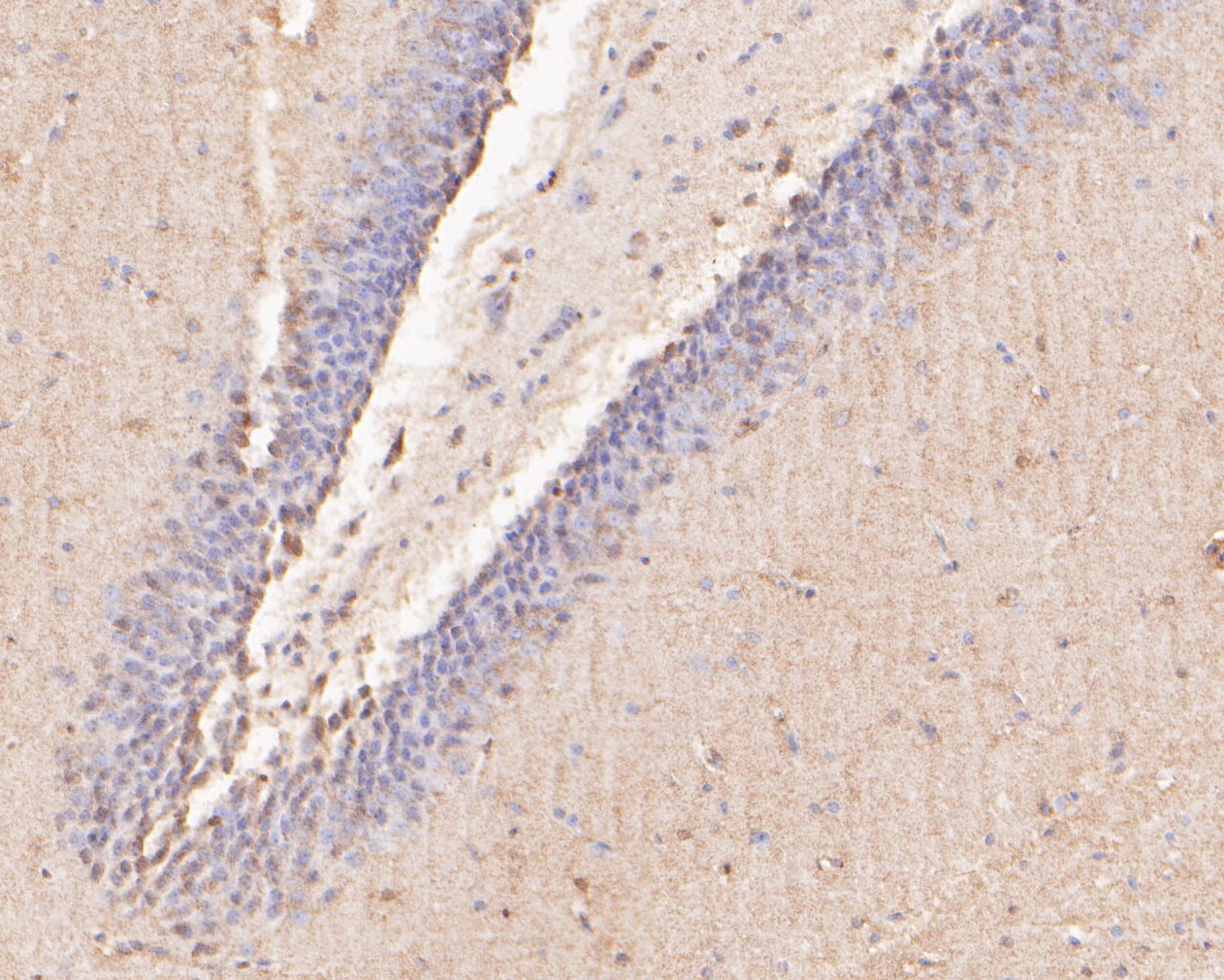 Immunohistochemical analysis of paraffin-embedded rat brain tissue using anti-TTL antibody. The section was pre-treated using heat mediated antigen retrieval with Tris-EDTA buffer (pH 8.0-8.4) for 20 minutes.The tissues were blocked in 5% BSA for 30 minutes at room temperature, washed with ddH2O and PBS, and then probed with the primary antibody (ER2001-11, 1/200) for 30 minutes at room temperature. The detection was performed using an HRP conjugated compact polymer system. DAB was used as the chromogen. Tissues were counterstained with hematoxylin and mounted with DPX.