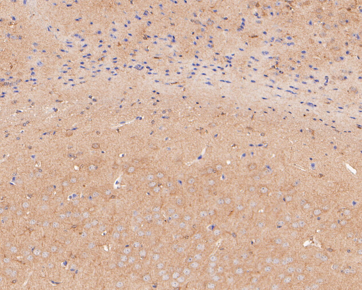 Immunohistochemical analysis of paraffin-embedded mouse brain tissue using anti-TTL antibody. The section was pre-treated using heat mediated antigen retrieval with Tris-EDTA buffer (pH 8.0-8.4) for 20 minutes.The tissues were blocked in 5% BSA for 30 minutes at room temperature, washed with ddH2O and PBS, and then probed with the primary antibody (ER2001-11, 1/200) for 30 minutes at room temperature. The detection was performed using an HRP conjugated compact polymer system. DAB was used as the chromogen. Tissues were counterstained with hematoxylin and mounted with DPX.