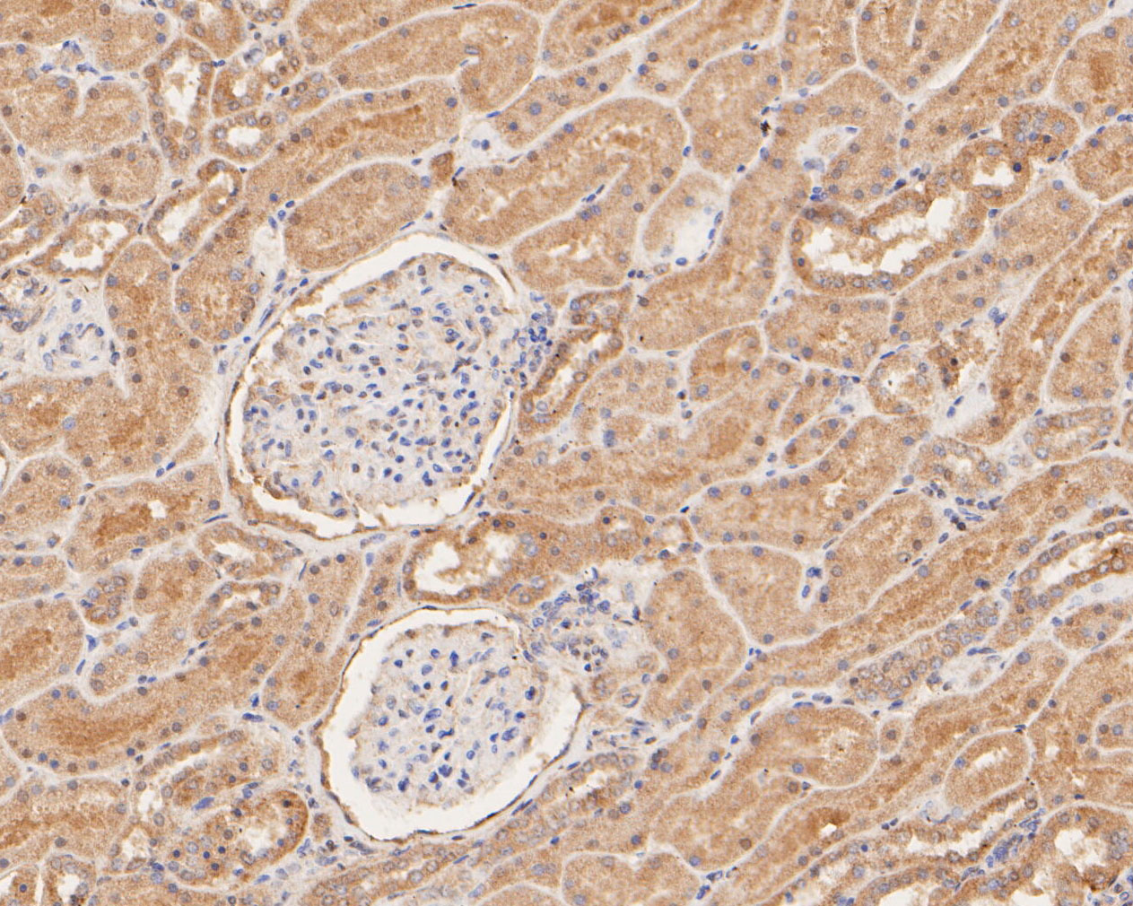 Immunohistochemical analysis of paraffin-embedded human kidney tissue using anti-GBP2 antibody. The section was pre-treated using heat mediated antigen retrieval with sodium citrate buffer (pH 6.0) for 20 minutes. The tissues were blocked in 5% BSA for 30 minutes at room temperature, washed with ddH2O and PBS, and then probed with the primary antibody (ER2001-12, 1/100)  for 30 minutes at room temperature. The detection was performed using an HRP conjugated compact polymer system. DAB was used as the chromogen. Tissues were counterstained with hematoxylin and mounted with DPX.