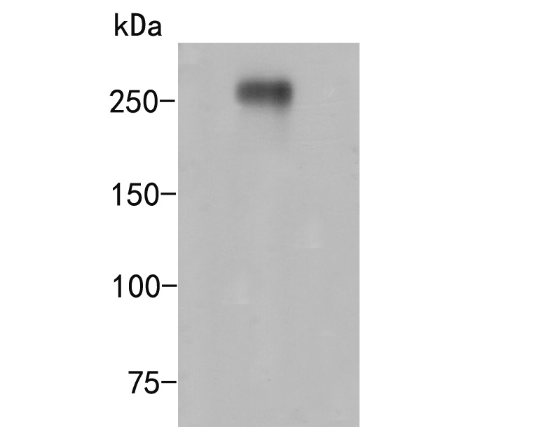 Western blot analysis of CD35 on HL-60 cell lysate. Proteins were transferred to a PVDF membrane and blocked with 5% BSA in PBS for 1 hour at room temperature. The primary antibody (ER2001-14, 1/500) was used in 5% BSA at room temperature for 2 hours. Goat Anti-Rabbit IgG - HRP Secondary Antibody (HA1001) at 1:5,000 dilution was used for 1 hour at room temperature.