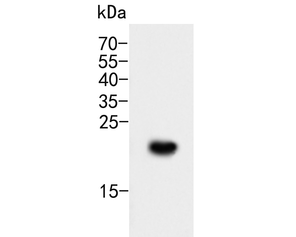 Western blot analysis of CD35 on recombinant protein lysate. Proteins were transferred to a PVDF membrane and blocked with 5% BSA in PBS for 1 hour at room temperature. The primary antibody (ER2001-14, 1/5000) was used in 5% BSA at room temperature for 2 hours. Goat Anti-Rabbit IgG - HRP Secondary Antibody (HA1001) at 1:5,000 dilution was used for 1 hour at room temperature.