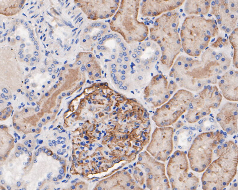 Immunohistochemical analysis of paraffin-embedded human kidney tissue using anti-CD35 antibody. The section was pre-treated using heat mediated antigen retrieval with Tris-EDTA buffer (pH 8.0-8.4) for 20 minutes.The tissues were blocked in 5% BSA for 30 minutes at room temperature, washed with ddH2O and PBS, and then probed with the primary antibody (ER2001-14, 1/200) for 30 minutes at room temperature. The detection was performed using an HRP conjugated compact polymer system. DAB was used as the chromogen. Tissues were counterstained with hematoxylin and mounted with DPX.