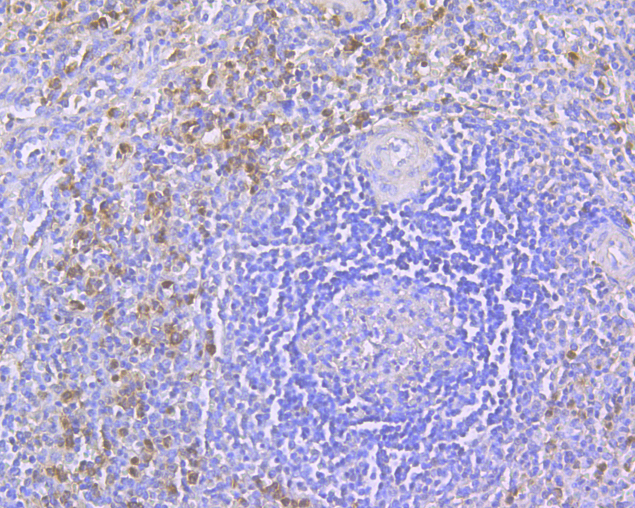 Immunohistochemical analysis of paraffin-embedded human spleen tissue using anti-CD163 antibody. The section was pre-treated using heat mediated antigen retrieval with Tris-EDTA buffer (pH 8.0-8.4) for 20 minutes.The tissues were blocked in 5% BSA for 30 minutes at room temperature, washed with ddH2O and PBS, and then probed with the primary antibody (ER2001-15, 1/200) for 30 minutes at room temperature. The detection was performed using an HRP conjugated compact polymer system. DAB was used as the chromogen. Tissues were counterstained with hematoxylin and mounted with DPX.