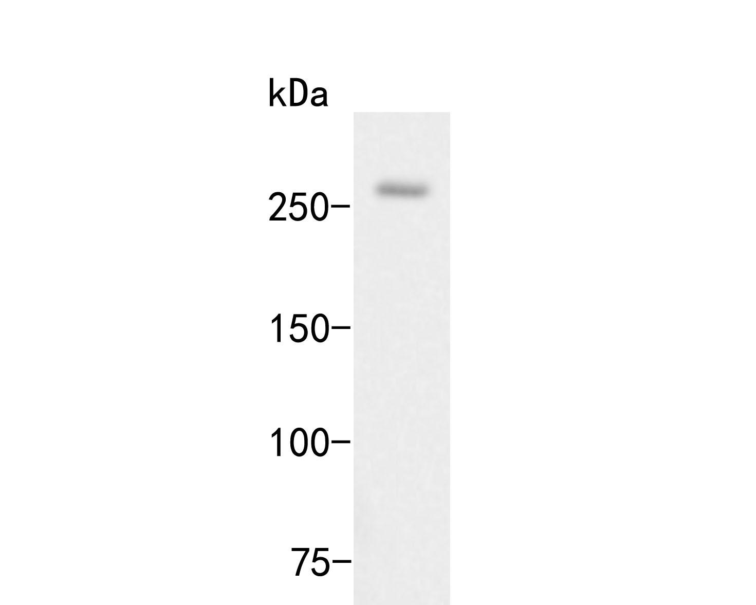 Western blot analysis of Myomegalin on NIH/3T3 cell lysates. Proteins were transferred to a PVDF membrane and blocked with 5% BSA in PBS for 1 hour at room temperature. The primary antibody (ER2001-16, 1/500) was used in 5% BSA at room temperature for 2 hours. Goat Anti-Rabbit IgG - HRP Secondary Antibody (HA1001) at 1:5,000 dilution was used for 1 hour at room temperature.