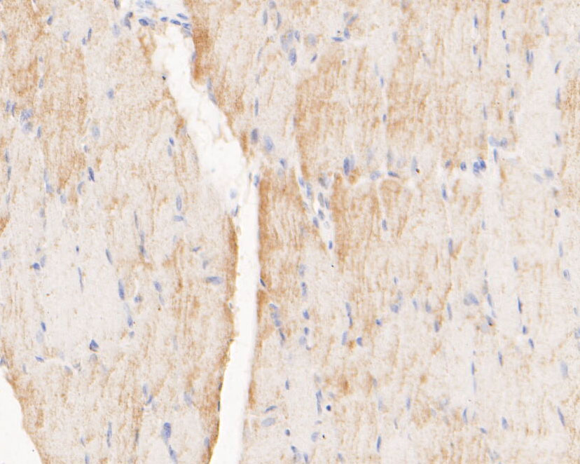 Immunohistochemical analysis of paraffin-embedded rat skeletal muscle tissue using anti-Myomegalin antibody. The section was pre-treated using heat mediated antigen retrieval with Tris-EDTA buffer (pH 8.0-8.4) for 20 minutes.The tissues were blocked in 5% BSA for 30 minutes at room temperature, washed with ddH2O and PBS, and then probed with the primary antibody (ER2001-16, 1/200) for 30 minutes at room temperature. The detection was performed using an HRP conjugated compact polymer system. DAB was used as the chromogen. Tissues were counterstained with hematoxylin and mounted with DPX.
