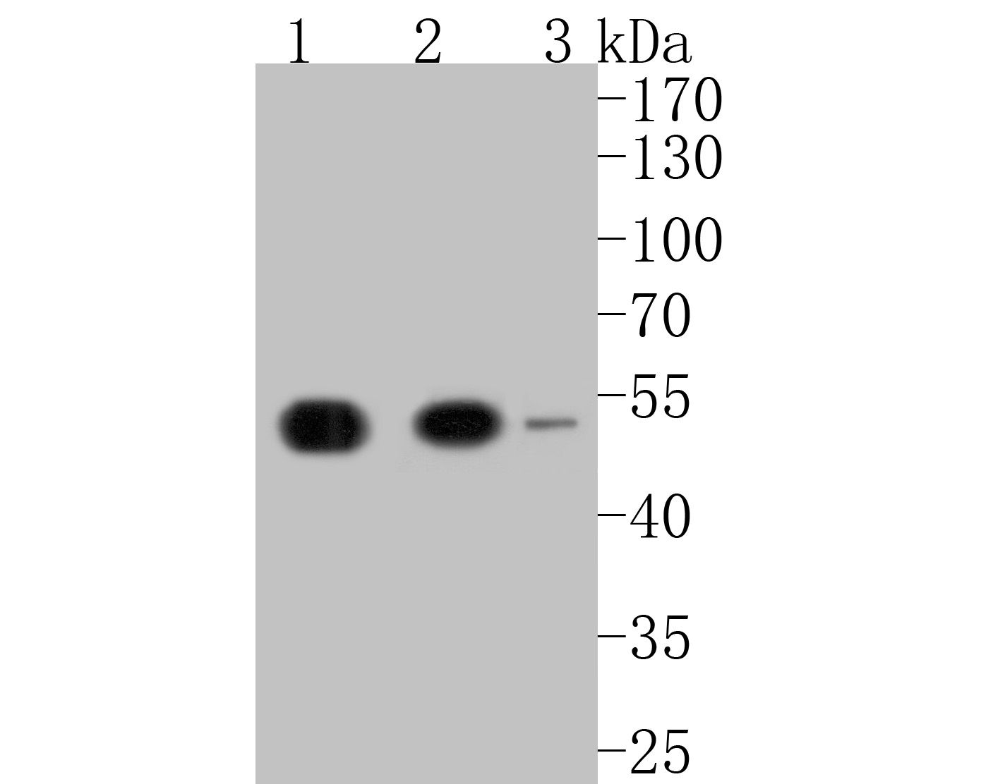 Western blot analysis of KPTN on different lysates. Proteins were transferred to a PVDF membrane and blocked with 5% BSA in PBS for 1 hour at room temperature. The primary antibody (ER2001-17, 1/500) was used in 5% BSA at room temperature for 2 hours. Goat Anti-Rabbit IgG - HRP Secondary Antibody (HA1001) at 1:5,000 dilution was used for 1 hour at room temperature.<br />
Positive control: <br />
Lane 1: HepG2 cell lysate<br />
Lane 2: SH-SY5Y cell lysate<br />
Lane 3: Rat brain tissue lysate