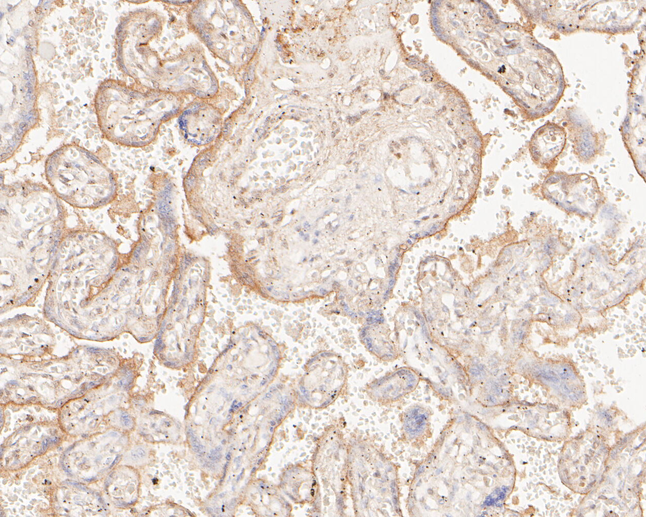 Immunohistochemical analysis of paraffin-embedded human placenta tissue using anti-KPTN antibody. The section was pre-treated using heat mediated antigen retrieval with Tris-EDTA buffer (pH 8.0-8.4) for 20 minutes.The tissues were blocked in 5% BSA for 30 minutes at room temperature, washed with ddH2O and PBS, and then probed with the primary antibody (ER2001-17, 1/200) for 30 minutes at room temperature. The detection was performed using an HRP conjugated compact polymer system. DAB was used as the chromogen. Tissues were counterstained with hematoxylin and mounted with DPX.