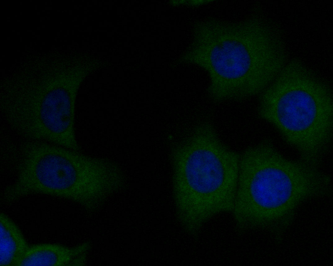 ICC staining of CD8 alpha in MCF-7 cells (green). Formalin fixed cells were permeabilized with 0.1% Triton X-100 in TBS for 10 minutes at room temperature and blocked with 1% Blocker BSA for 15 minutes at room temperature. Cells were probed with the primary antibody (ER2001-19, 1/100) for 1 hour at room temperature, washed with PBS. Alexa Fluor®488 Goat anti-Rabbit IgG was used as the secondary antibody at 1/100 dilution. The nuclear counter stain is DAPI (blue).