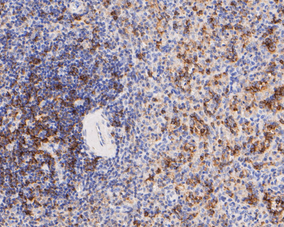 Immunohistochemical analysis of paraffin-embedded human spleen tissue using anti-CD8 alpha antibody. The section was pre-treated using heat mediated antigen retrieval with Tris-EDTA buffer (pH 8.0-8.4) for 20 minutes.The tissues were blocked in 5% BSA for 30 minutes at room temperature, washed with ddH2O and PBS, and then probed with the primary antibody (ER2001-19, 1/200) for 30 minutes at room temperature. The detection was performed using an HRP conjugated compact polymer system. DAB was used as the chromogen. Tissues were counterstained with hematoxylin and mounted with DPX.