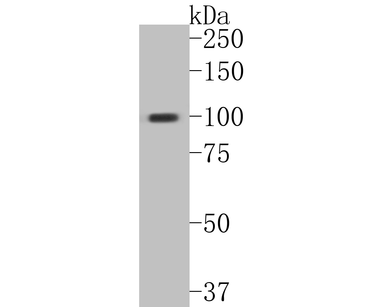 Western blot analysis of DNA2 on human stomach tissue lysates. Proteins were transferred to a PVDF membrane and blocked with 5% BSA in PBS for 1 hour at room temperature. The primary antibody (ER2001-20, 1/500) was used in 5% BSA at room temperature for 2 hours. Goat Anti-Rabbit IgG - HRP Secondary Antibody (HA1001) at 1:5,000 dilution was used for 1 hour at room temperature.