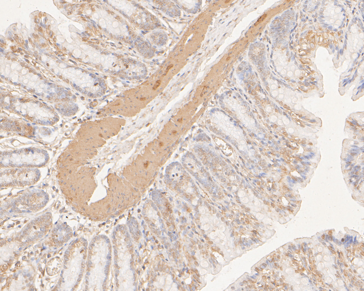 Immunohistochemical analysis of paraffin-embedded rat large intestine tissue using anti-DNA2 antibody. The section was pre-treated using heat mediated antigen retrieval with sodium citrate buffer (pH 6.0) for 20 minutes. The tissues were blocked in 5% BSA for 30 minutes at room temperature, washed with ddH2O and PBS, and then probed with the primary antibody (ER2001-20, 1/400)  for 30 minutes at room temperature. The detection was performed using an HRP conjugated compact polymer system. DAB was used as the chromogen. Tissues were counterstained with hematoxylin and mounted with DPX.
