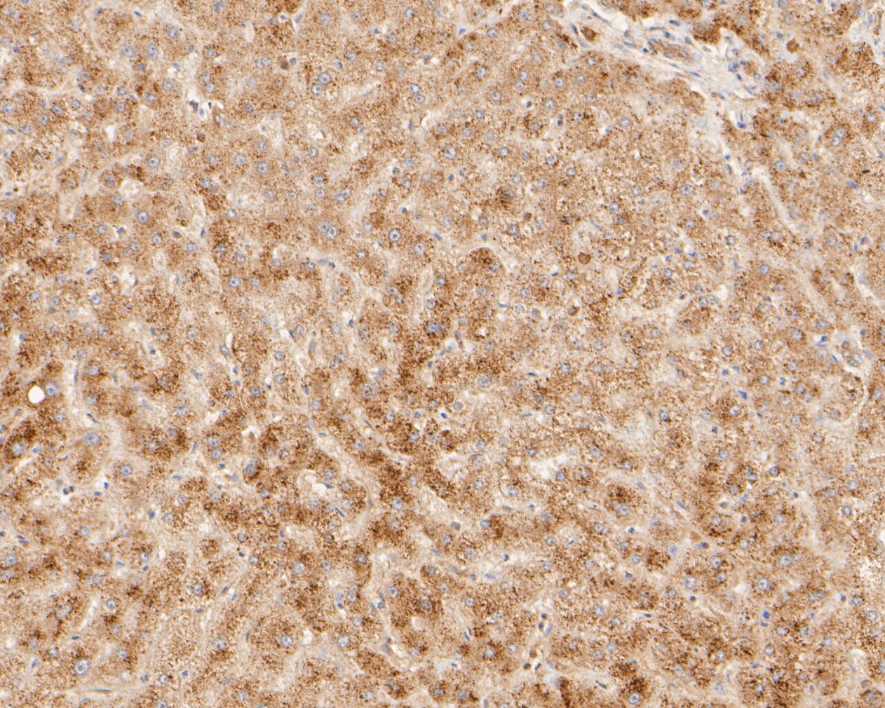 Immunohistochemical analysis of paraffin-embedded human liver tissue using anti-DNA2 antibody. The section was pre-treated using heat mediated antigen retrieval with sodium citrate buffer (pH 6.0) for 20 minutes. The tissues were blocked in 5% BSA for 30 minutes at room temperature, washed with ddH2O and PBS, and then probed with the primary antibody (ER2001-20, 1/400)  for 30 minutes at room temperature. The detection was performed using an HRP conjugated compact polymer system. DAB was used as the chromogen. Tissues were counterstained with hematoxylin and mounted with DPX.