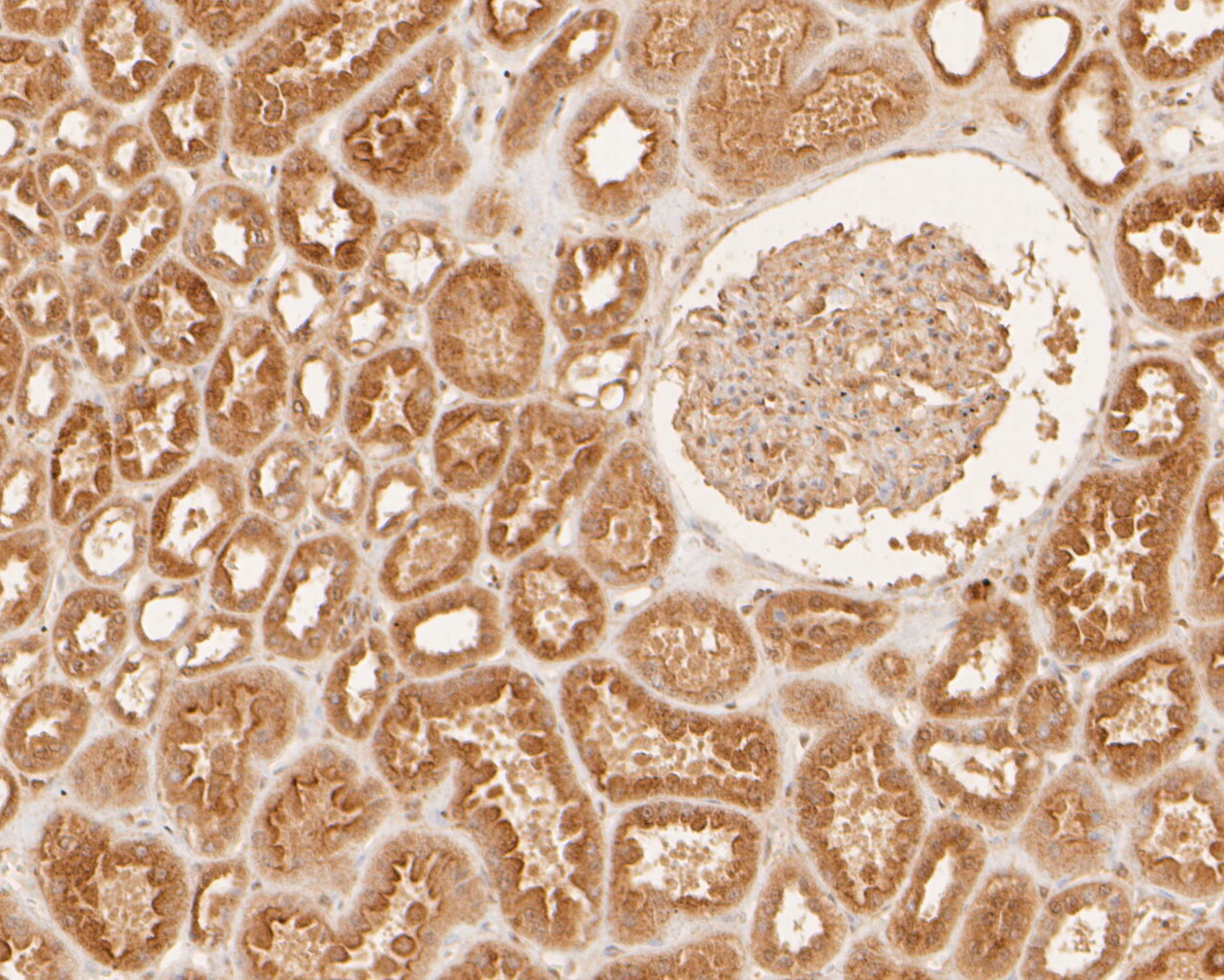 Immunohistochemical analysis of paraffin-embedded human kidney tissue using anti-DNA2 antibody. The section was pre-treated using heat mediated antigen retrieval with sodium citrate buffer (pH 6.0) for 20 minutes. The tissues were blocked in 5% BSA for 30 minutes at room temperature, washed with ddH2O and PBS, and then probed with the primary antibody (ER2001-20, 1/400)  for 30 minutes at room temperature. The detection was performed using an HRP conjugated compact polymer system. DAB was used as the chromogen. Tissues were counterstained with hematoxylin and mounted with DPX.