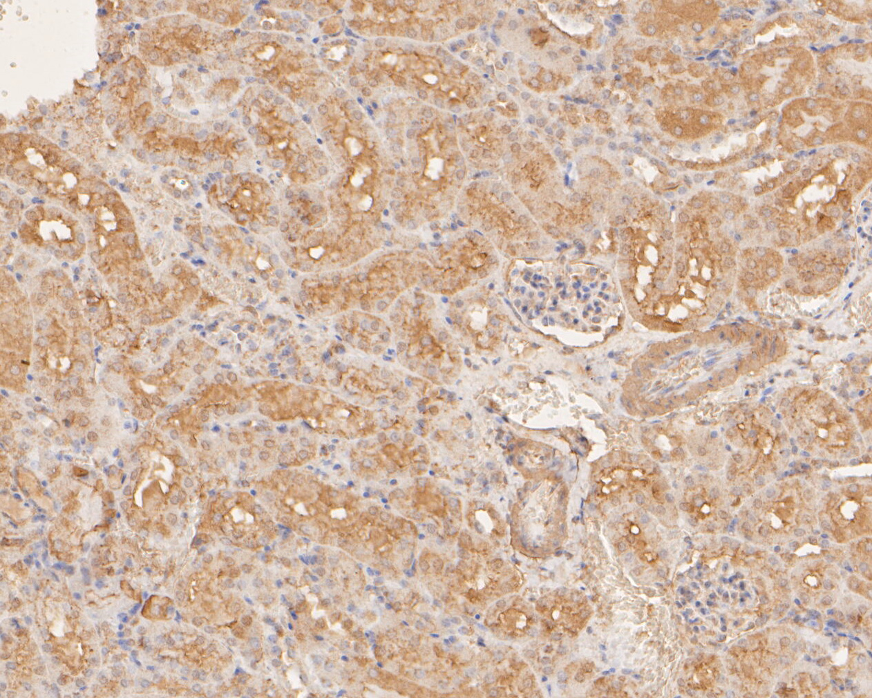 Immunohistochemical analysis of paraffin-embedded mouse kidney tissue using anti-DNA2 antibody. The section was pre-treated using heat mediated antigen retrieval with sodium citrate buffer (pH 6.0) for 20 minutes. The tissues were blocked in 5% BSA for 30 minutes at room temperature, washed with ddH2O and PBS, and then probed with the primary antibody (ER2001-20, 1/400)  for 30 minutes at room temperature. The detection was performed using an HRP conjugated compact polymer system. DAB was used as the chromogen. Tissues were counterstained with hematoxylin and mounted with DPX.