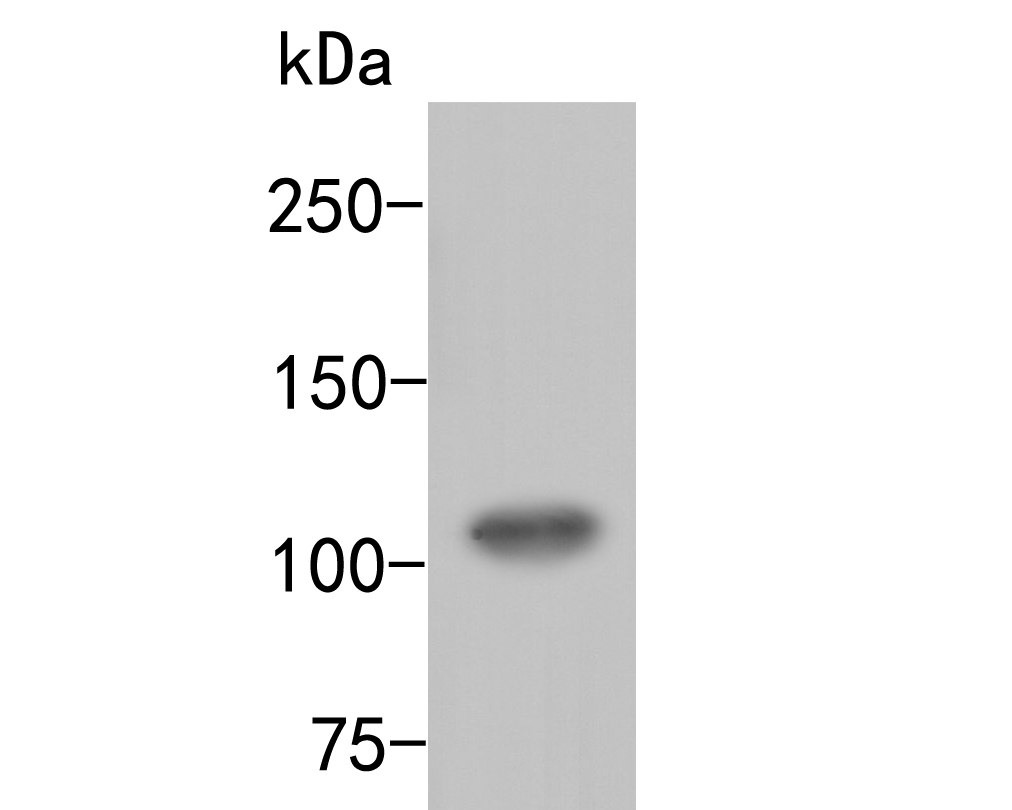 Western blot analysis of ARF16 on rice tissue lysate. Proteins were transferred to a PVDF membrane and blocked with 5% BSA in PBS for 1 hour at room temperature. The primary antibody (ER2001-21, 1/500) was used in 5% BSA at room temperature for 2 hours. Goat Anti-Rabbit IgG - HRP Secondary Antibody (HA1001) at 1:5,000 dilution was used for 1 hour at room temperature.