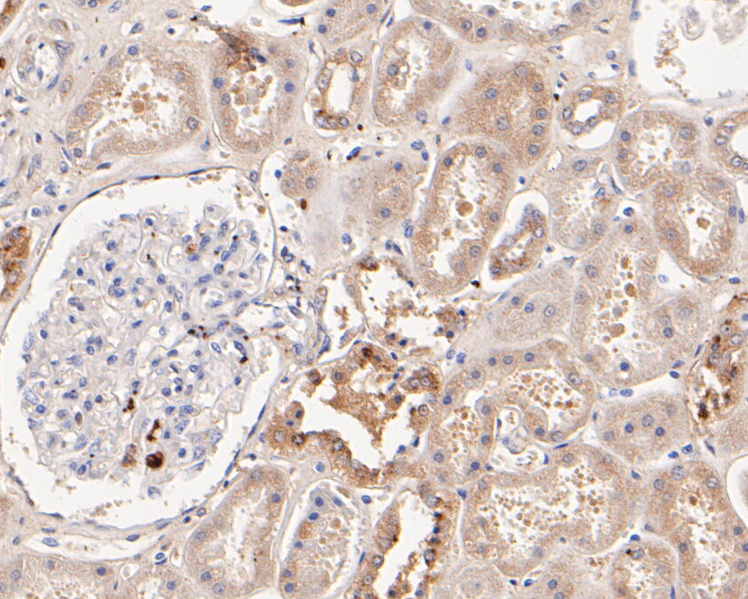 Immunohistochemical analysis of paraffin-embedded human kidney  tissue using anti-GOLGA7 antibody. The section was pre-treated using heat mediated antigen retrieval with Tris-EDTA buffer (pH 8.0-8.4) for 20 minutes.The tissues were blocked in 5% BSA for 30 minutes at room temperature, washed with ddH2O and PBS, and then probed with the primary antibody (ER2001-22, 1/200) for 30 minutes at room temperature. The detection was performed using an HRP conjugated compact polymer system. DAB was used as the chromogen. Tissues were counterstained with hematoxylin and mounted with DPX.