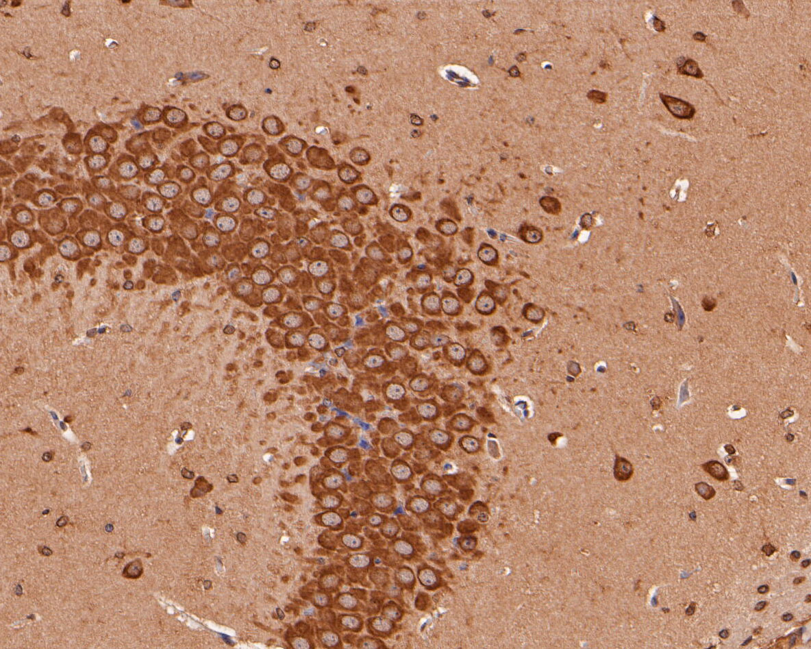 Immunohistochemical analysis of paraffin-embedded mouse brain tissue using anti-KCNQ4 antibody. The section was pre-treated using heat mediated antigen retrieval with Tris-EDTA buffer (pH 8.0-8.4) for 20 minutes.The tissues were blocked in 5% BSA for 30 minutes at room temperature, washed with ddH2O and PBS, and then probed with the primary antibody (ER2001-23, 1/50) for 30 minutes at room temperature. The detection was performed using an HRP conjugated compact polymer system. DAB was used as the chromogen. Tissues were counterstained with hematoxylin and mounted with DPX.