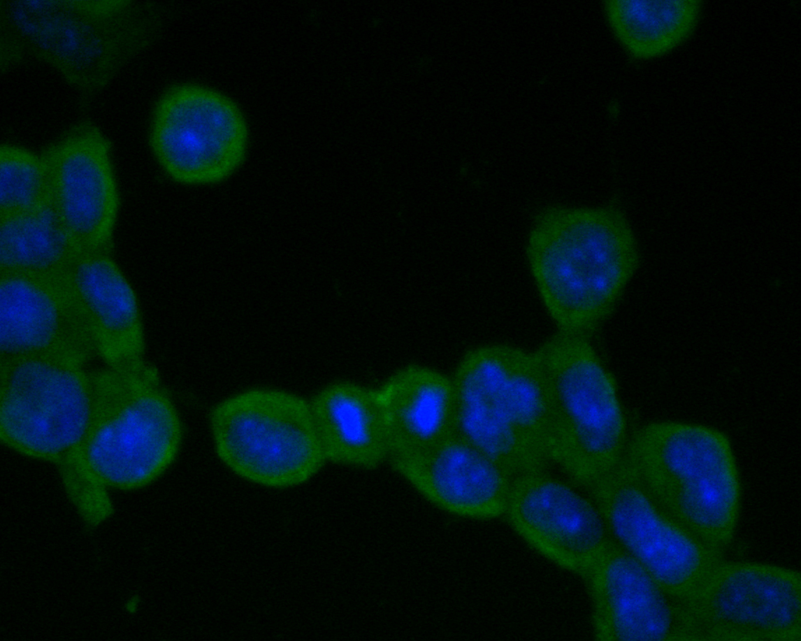 ICC staining of ADAM22 in F9 cells (green). Formalin fixed cells were permeabilized with 0.1% Triton X-100 in TBS for 10 minutes at room temperature and blocked with 1% Blocker BSA for 15 minutes at room temperature. Cells were probed with the primary antibody (ER2001-24, 1/100) for 1 hour at room temperature, washed with PBS. Alexa Fluor®488 Goat anti-Rabbit IgG was used as the secondary antibody at 1/100 dilution. The nuclear counter stain is DAPI (blue).