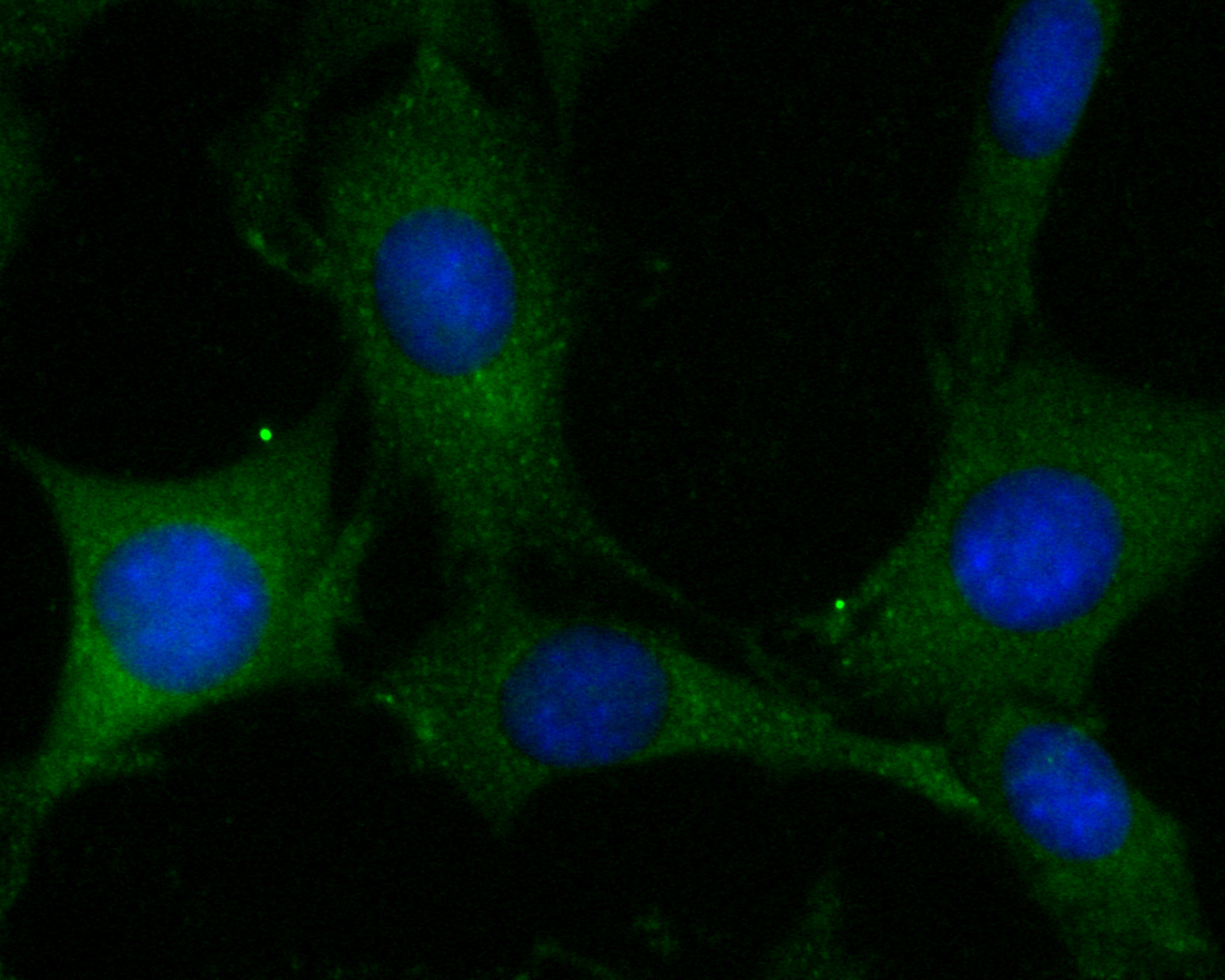 ICC staining of ADAM22 in SHG-44 cells (green). Formalin fixed cells were permeabilized with 0.1% Triton X-100 in TBS for 10 minutes at room temperature and blocked with 1% Blocker BSA for 15 minutes at room temperature. Cells were probed with the primary antibody (ER2001-24, 1/100) for 1 hour at room temperature, washed with PBS. Alexa Fluor®488 Goat anti-Rabbit IgG was used as the secondary antibody at 1/100 dilution. The nuclear counter stain is DAPI (blue).
