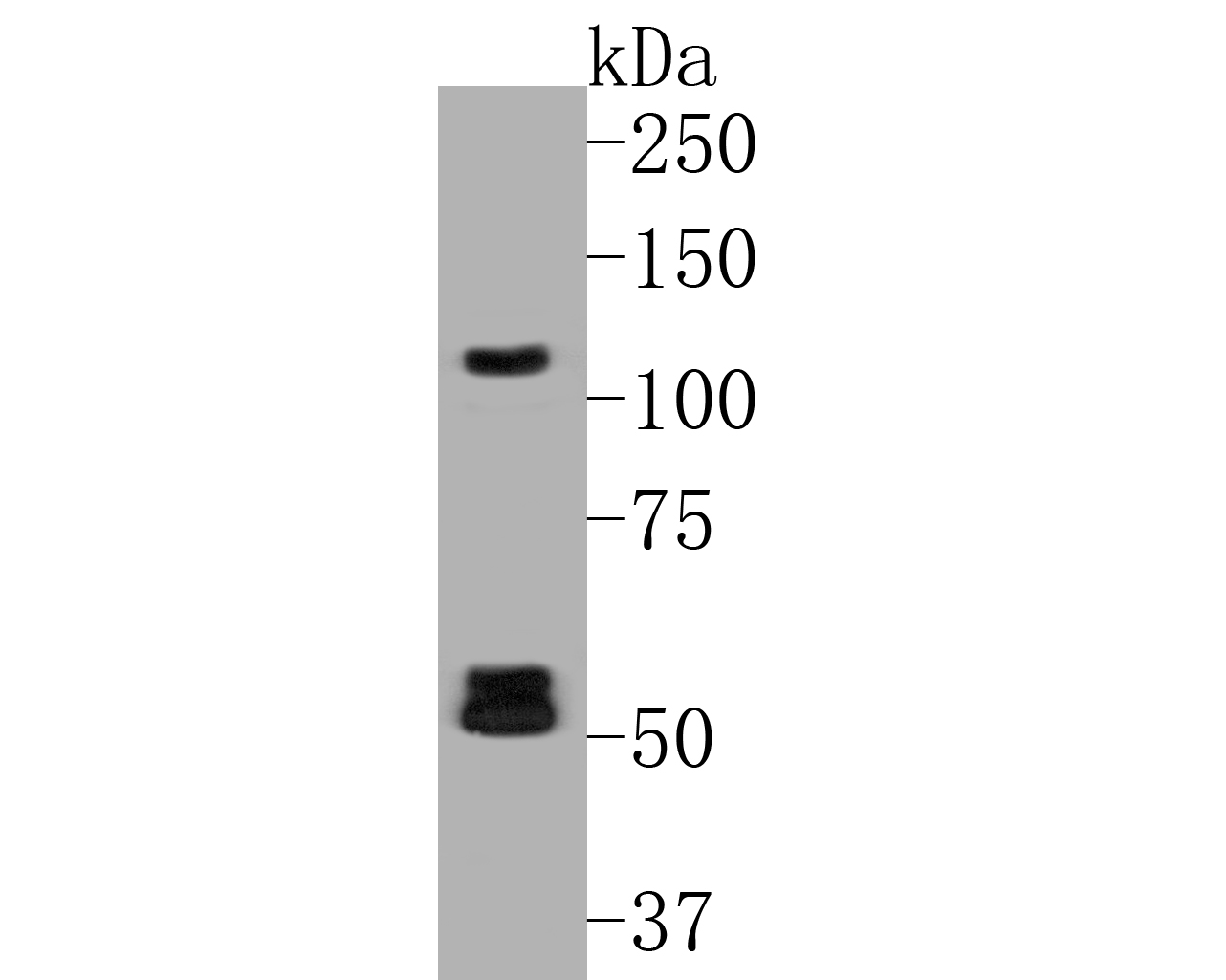Western blot analysis of Flt3 on rat testis lysates. Proteins were transferred to a PVDF membrane and blocked with 5% BSA in PBS for 1 hour at room temperature. The primary antibody (ER2001-25, 1/500) was used in 5% BSA at room temperature for 2 hours. Goat Anti-Rabbit IgG - HRP Secondary Antibody (HA1001) at 1:5,000 dilution was used for 1 hour at room temperature.