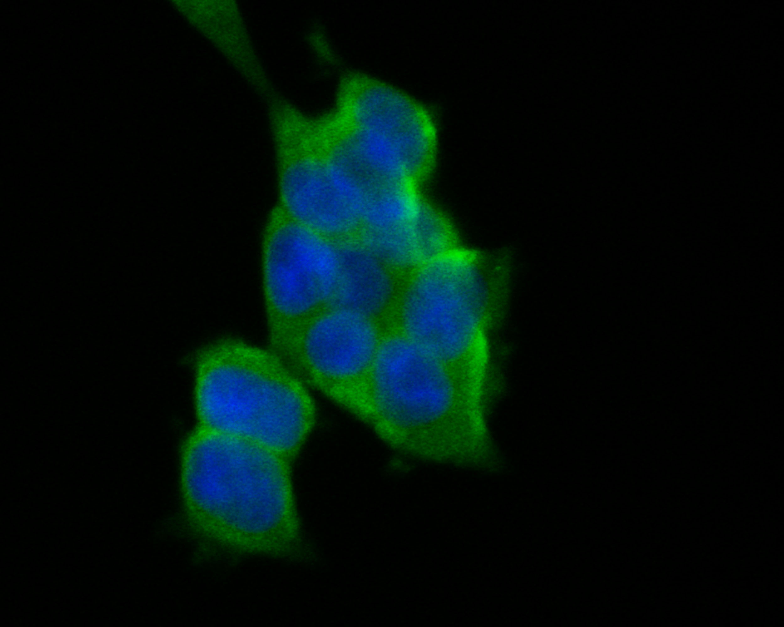ICC staining of Flt3 in 293T cells (green). Formalin fixed cells were permeabilized with 0.1% Triton X-100 in TBS for 10 minutes at room temperature and blocked with 1% Blocker BSA for 15 minutes at room temperature. Cells were probed with the primary antibody (ER2001-25, 1/50) for 1 hour at room temperature, washed with PBS. Alexa Fluor®488 Goat anti-Rabbit IgG was used as the secondary antibody at 1/1,000 dilution. The nuclear counter stain is DAPI (blue).