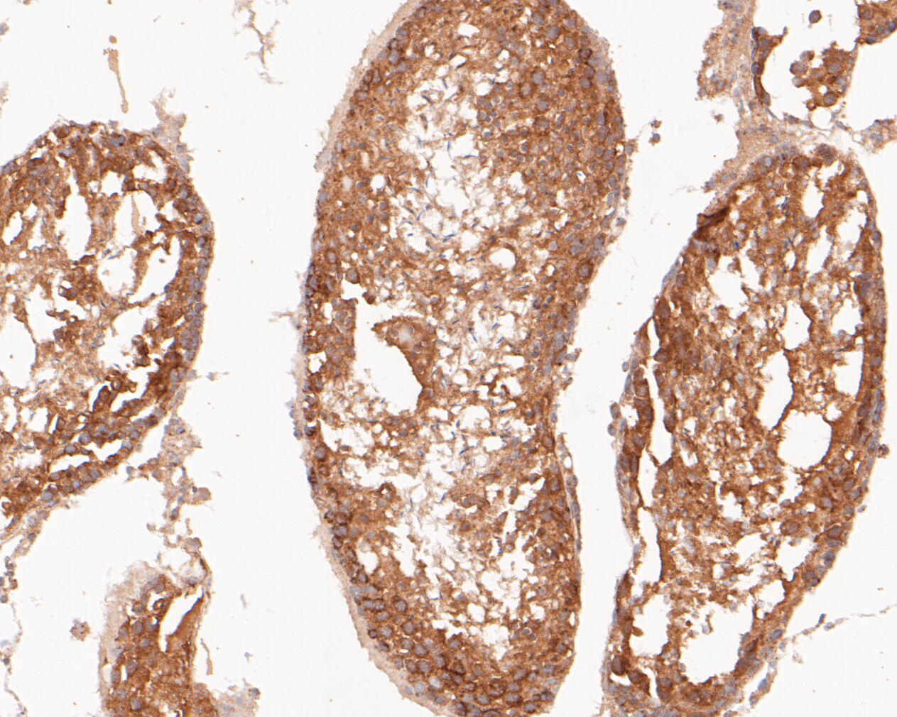 Immunohistochemical analysis of paraffin-embedded rat testis tissue using anti-Flt3 antibody. The section was pre-treated using heat mediated antigen retrieval with Tris-EDTA buffer (pH 8.0-8.4) for 20 minutes.The tissues were blocked in 5% BSA for 30 minutes at room temperature, washed with ddH2O and PBS, and then probed with the primary antibody (ER2001-25, 1/50) for 30 minutes at room temperature. The detection was performed using an HRP conjugated compact polymer system. DAB was used as the chromogen. Tissues were counterstained with hematoxylin and mounted with DPX.