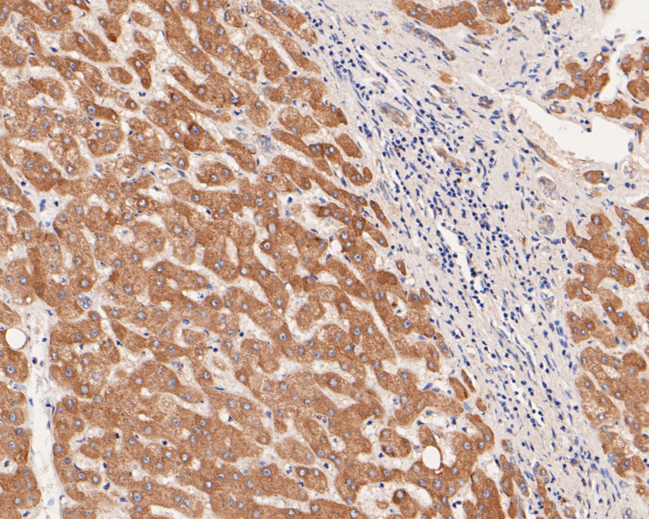Immunohistochemical analysis of paraffin-embedded human liver tissue using anti-Flt3 antibody. The section was pre-treated using heat mediated antigen retrieval with Tris-EDTA buffer (pH 8.0-8.4) for 20 minutes.The tissues were blocked in 5% BSA for 30 minutes at room temperature, washed with ddH2O and PBS, and then probed with the primary antibody (ER2001-25, 1/50) for 30 minutes at room temperature. The detection was performed using an HRP conjugated compact polymer system. DAB was used as the chromogen. Tissues were counterstained with hematoxylin and mounted with DPX.