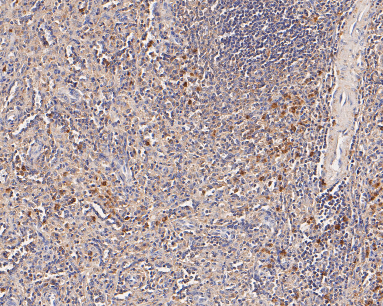 Immunohistochemical analysis of paraffin-embedded human spleen tissue using anti-Flt3 antibody. The section was pre-treated using heat mediated antigen retrieval with Tris-EDTA buffer (pH 8.0-8.4) for 20 minutes.The tissues were blocked in 5% BSA for 30 minutes at room temperature, washed with ddH2O and PBS, and then probed with the primary antibody (ER2001-25, 1/50) for 30 minutes at room temperature. The detection was performed using an HRP conjugated compact polymer system. DAB was used as the chromogen. Tissues were counterstained with hematoxylin and mounted with DPX.