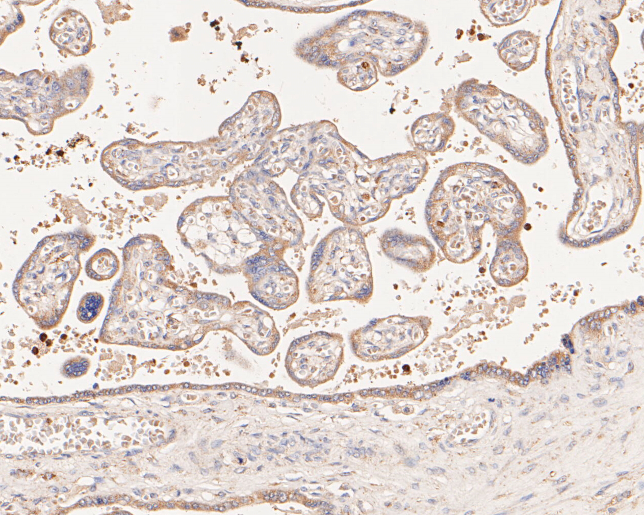 Immunohistochemical analysis of paraffin-embedded human placenta tissue using anti-Flt3 antibody. The section was pre-treated using heat mediated antigen retrieval with Tris-EDTA buffer (pH 8.0-8.4) for 20 minutes.The tissues were blocked in 5% BSA for 30 minutes at room temperature, washed with ddH2O and PBS, and then probed with the primary antibody (ER2001-25, 1/50) for 30 minutes at room temperature. The detection was performed using an HRP conjugated compact polymer system. DAB was used as the chromogen. Tissues were counterstained with hematoxylin and mounted with DPX.