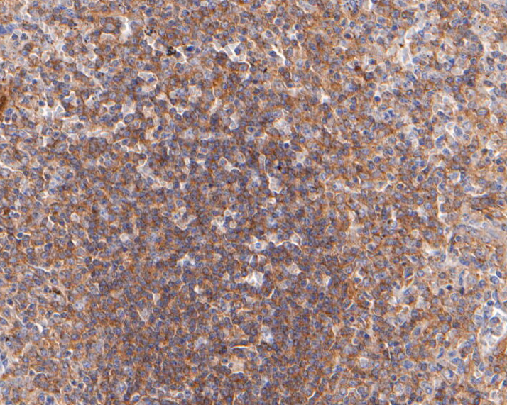 Immunohistochemical analysis of paraffin-embedded human spleen  tissue using anti-Dysbindin antibody. The section was pre-treated using heat mediated antigen retrieval with sodium citrate buffer (pH 6.0) for 20 minutes. The tissues were blocked in 5% BSA for 30 minutes at room temperature, washed with ddH2O and PBS, and then probed with the primary antibody (ER2001-26, 1/100)  for 30 minutes at room temperature. The detection was performed using an HRP conjugated compact polymer system. DAB was used as the chromogen. Tissues were counterstained with hematoxylin and mounted with DPX.
