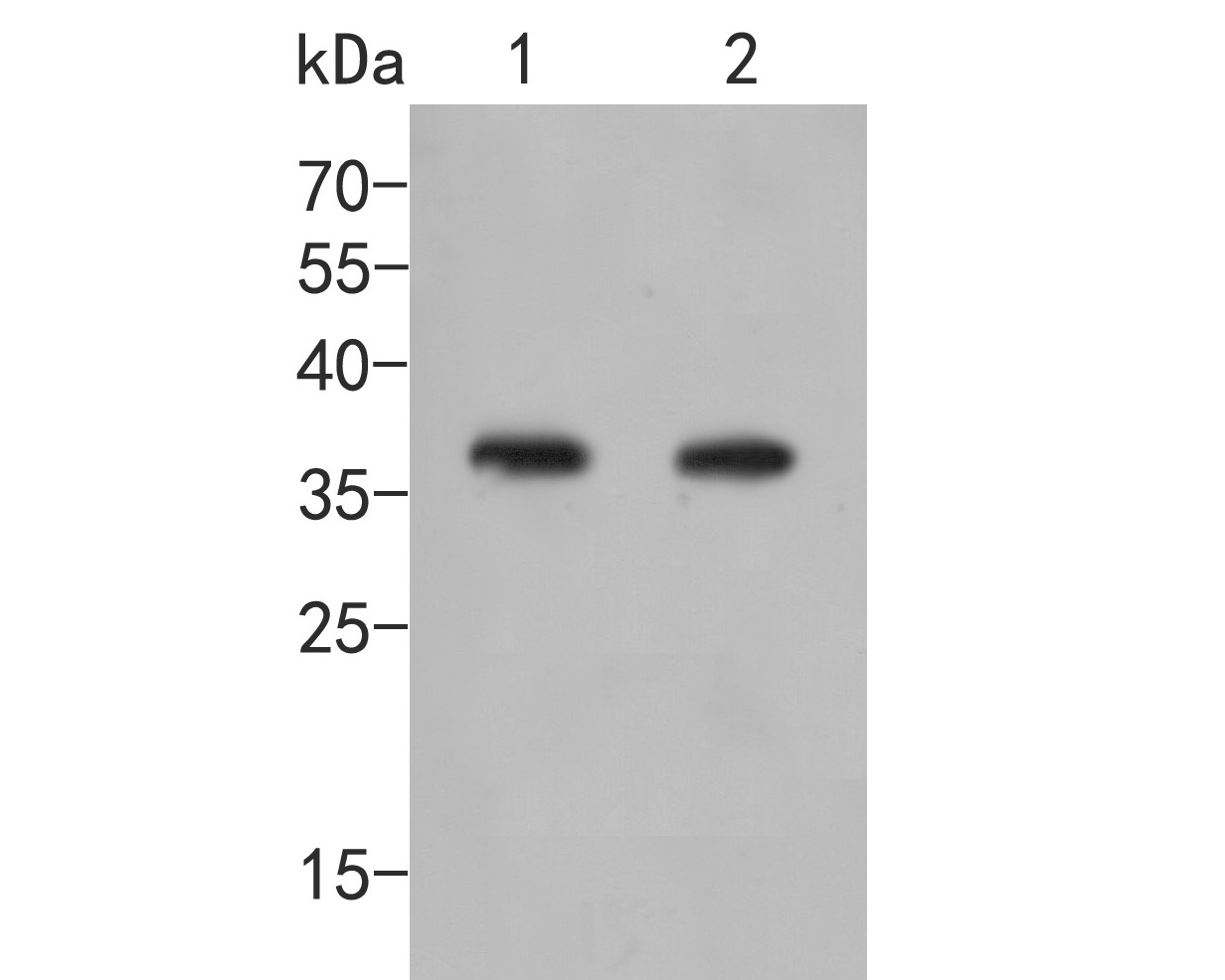 Immunohistochemical analysis of paraffin-embedded rat seminal vesicle tissue using anti-AKR1B1 antibody. The section was pre-treated using heat mediated antigen retrieval with sodium citrate buffer (pH 6.0) for 20 minutes. The tissues were blocked in 5% BSA for 30 minutes at room temperature, washed with ddH2O and PBS, and then probed with the primary antibody (ER2001-27, 1/400)  for 30 minutes at room temperature. The detection was performed using an HRP conjugated compact polymer system. DAB was used as the chromogen. Tissues were counterstained with hematoxylin and mounted with DPX.