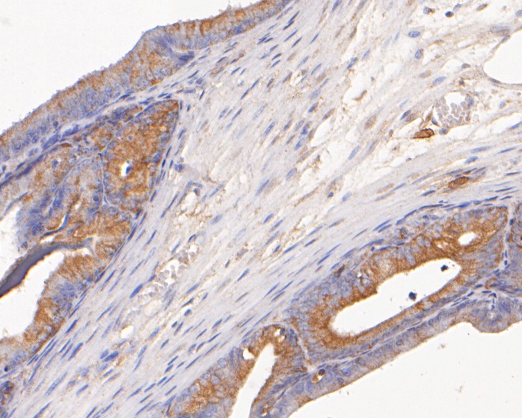 Immunohistochemical analysis of paraffin-embedded human seminal vesicle tissue using anti-AKR1B1 antibody. The section was pre-treated using heat mediated antigen retrieval with sodium citrate buffer (pH 6.0) for 20 minutes. The tissues were blocked in 5% BSA for 30 minutes at room temperature, washed with ddH2O and PBS, and then probed with the primary antibody (ER2001-27, 1/400)  for 30 minutes at room temperature. The detection was performed using an HRP conjugated compact polymer system. DAB was used as the chromogen. Tissues were counterstained with hematoxylin and mounted with DPX.