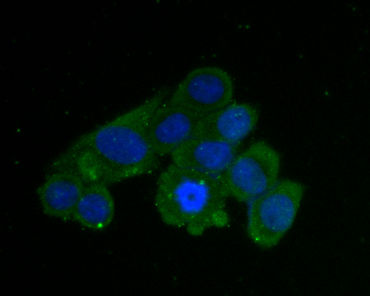 ICC staining of AKR1B1 in Siha cells (green). Formalin fixed cells were permeabilized with 0.1% Triton X-100 in TBS for 10 minutes at room temperature and blocked with 1% Blocker BSA for 15 minutes at room temperature. Cells were probed with the primary antibody (ER2001-28, 1/50) for 1 hour at room temperature, washed with PBS. Alexa Fluor®488 Goat anti-Rabbit IgG was used as the secondary antibody at 1/1,000 dilution. The nuclear counter stain is DAPI (blue).