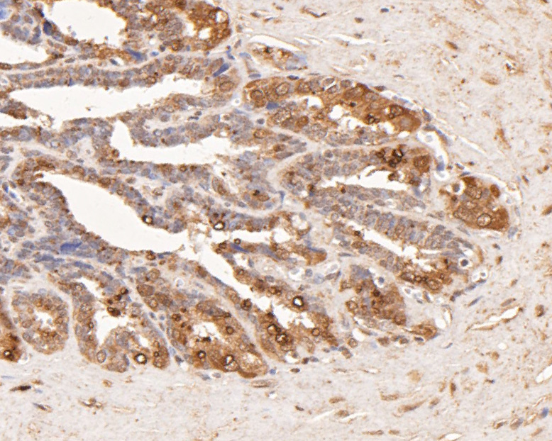 Immunohistochemical analysis of paraffin-embedded human seminal vesicle tissue using anti-AKR1B1 antibody. The section was pre-treated using heat mediated antigen retrieval with sodium citrate buffer (pH 6.0) for 20 minutes. The tissues were blocked in 5% BSA for 30 minutes at room temperature, washed with ddH2O and PBS, and then probed with the primary antibody (ER2001-28, 1/400) for 30 minutes at room temperature. The detection was performed using an HRP conjugated compact polymer system. DAB was used as the chromogen. Tissues were counterstained with hematoxylin and mounted with DPX.