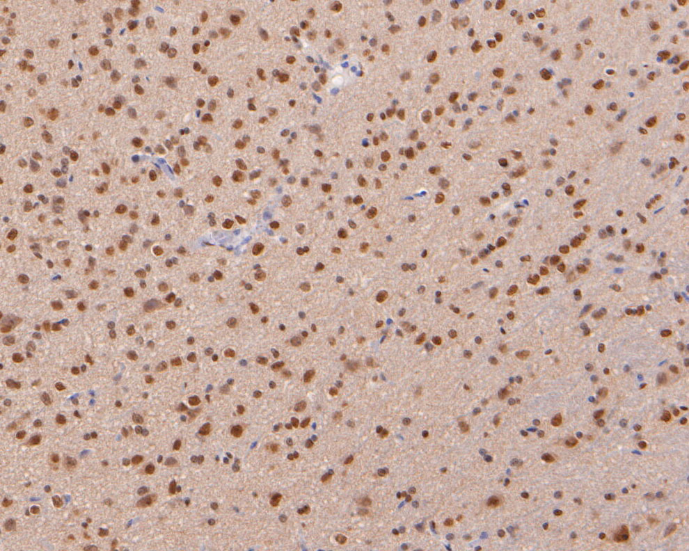 Immunohistochemical analysis of paraffin-embedded rat brain tissue using anti-COPS8 antibody. The section was pre-treated using heat mediated antigen retrieval with sodium citrate buffer (pH 6.0) for 20 minutes. The tissues were blocked in 5% BSA for 30 minutes at room temperature, washed with ddH2O and PBS, and then probed with the primary antibody (ER2001-29, 1/400)  for 30 minutes at room temperature. The detection was performed using an HRP conjugated compact polymer system. DAB was used as the chromogen. Tissues were counterstained with hematoxylin and mounted with DPX.