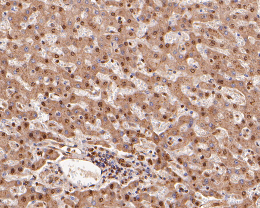 Immunohistochemical analysis of paraffin-embedded human liver tissue using anti-COPS8 antibody. The section was pre-treated using heat mediated antigen retrieval with sodium citrate buffer (pH 6.0) for 20 minutes. The tissues were blocked in 5% BSA for 30 minutes at room temperature, washed with ddH2O and PBS, and then probed with the primary antibody (ER2001-29, 1/400)  for 30 minutes at room temperature. The detection was performed using an HRP conjugated compact polymer system. DAB was used as the chromogen. Tissues were counterstained with hematoxylin and mounted with DPX.