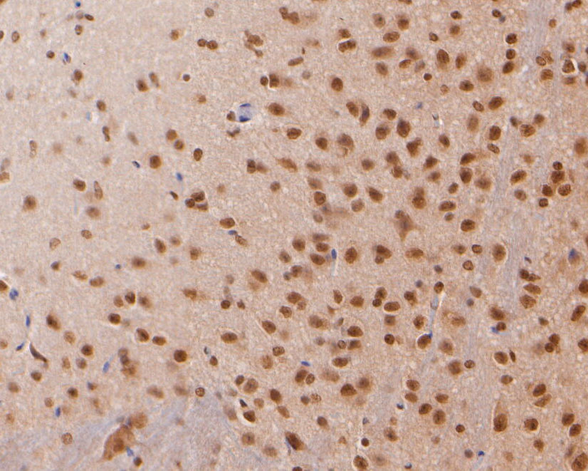 Immunohistochemical analysis of paraffin-embedded mouse brain tissue using anti-COPS8 antibody. The section was pre-treated using heat mediated antigen retrieval with sodium citrate buffer (pH 6.0) for 20 minutes. The tissues were blocked in 5% BSA for 30 minutes at room temperature, washed with ddH2O and PBS, and then probed with the primary antibody (ER2001-29, 1/400)  for 30 minutes at room temperature. The detection was performed using an HRP conjugated compact polymer system. DAB was used as the chromogen. Tissues were counterstained with hematoxylin and mounted with DPX.
