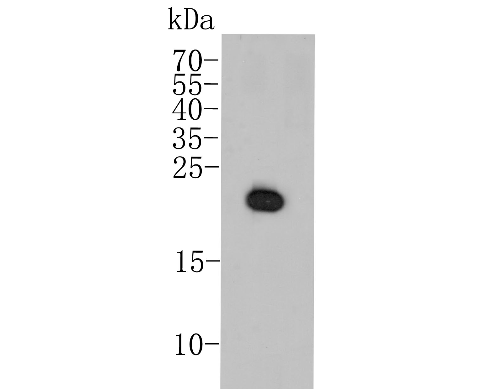 Western blot analysis of CDKN2A/p16INK4a on mouse brain tissue lysate. Proteins were transferred to a PVDF membrane and blocked with 5% BSA in PBS for 1 hour at room temperature. The primary antibody (ER2001-30, 1/500) was used in 5% BSA at room temperature for 2 hours. Goat Anti-Rabbit IgG - HRP Secondary Antibody (HA1001) at 1:5,000 dilution was used for 1 hour at room temperature.