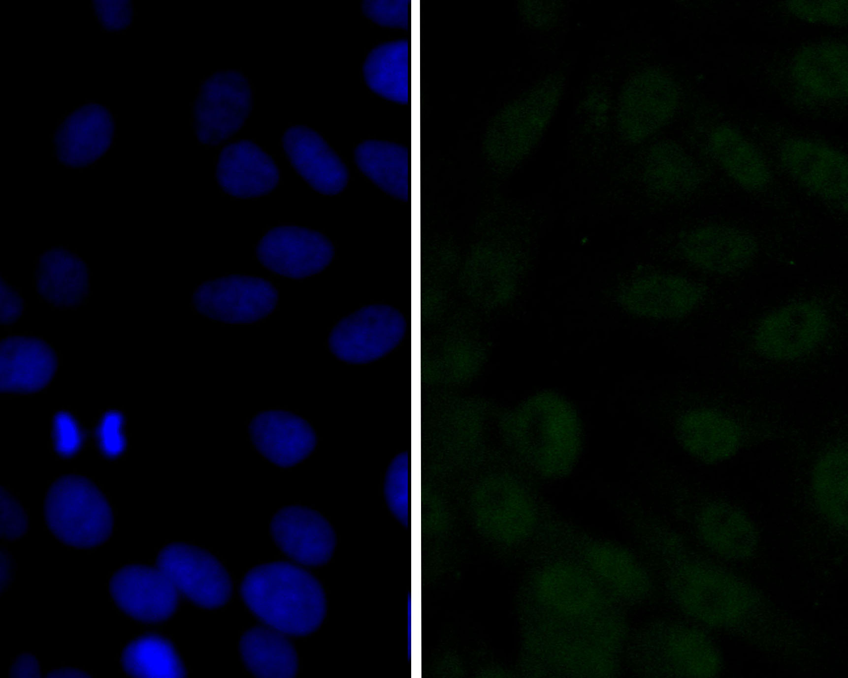 ICC staining of CDKN2A/p16INK4a in MCF-7 cells (green). Formalin fixed cells were permeabilized with 0.1% Triton X-100 in TBS for 10 minutes at room temperature and blocked with 1% Blocker BSA for 15 minutes at room temperature. Cells were probed with the primary antibody (ER2001-30, 1/100) for 1 hour at room temperature, washed with PBS. Alexa Fluor®488 Goat anti-Rabbit IgG was used as the secondary antibody at 1/100 dilution. The nuclear counter stain is DAPI (blue).
