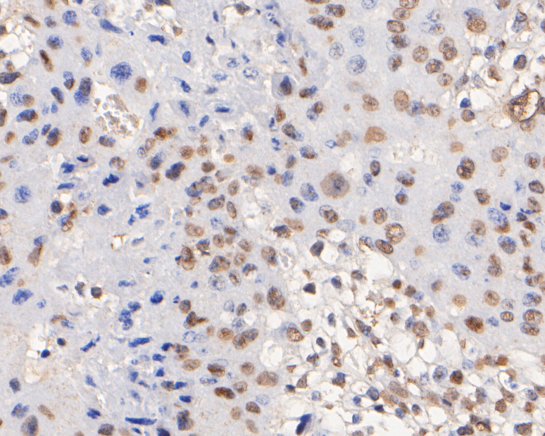 Immunohistochemical analysis of paraffin-embedded mouse placenta tissue using anti-CDKN2A/p16INK4a antibody. The section was pre-treated using heat mediated antigen retrieval with sodium citrate buffer (pH 6.0) for 20 minutes. The tissues were blocked in 5% BSA for 30 minutes at room temperature, washed with ddH2O and PBS, and then probed with the primary antibody (ER2001-30, 1/100)  for 30 minutes at room temperature. The detection was performed using an HRP conjugated compact polymer system. DAB was used as the chromogen. Tissues were counterstained with hematoxylin and mounted with DPX.