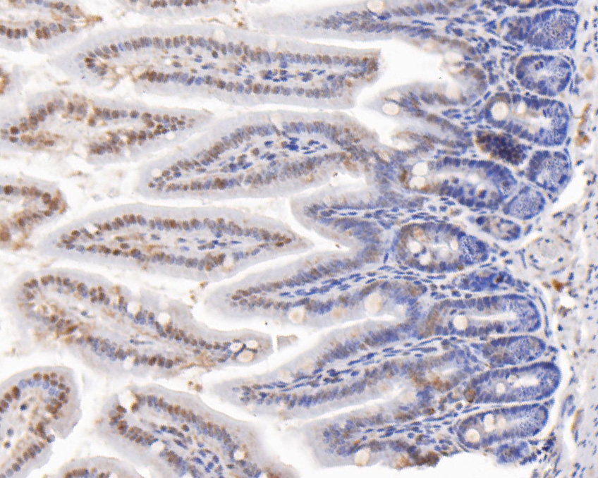 Immunohistochemical analysis of paraffin-embedded mouse colon tissue using anti-CDKN2A/p16INK4a antibody. The section was pre-treated using heat mediated antigen retrieval with sodium citrate buffer (pH 6.0) for 20 minutes. The tissues were blocked in 5% BSA for 30 minutes at room temperature, washed with ddH2O and PBS, and then probed with the primary antibody (ER2001-30, 1/200)  for 30 minutes at room temperature. The detection was performed using an HRP conjugated compact polymer system. DAB was used as the chromogen. Tissues were counterstained with hematoxylin and mounted with DPX.