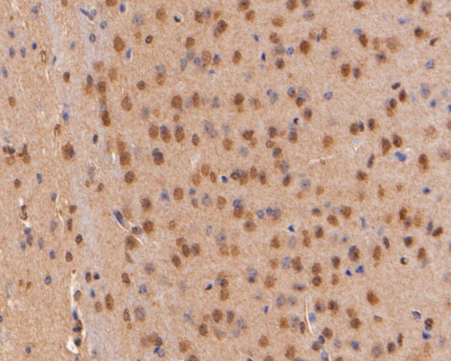 Immunohistochemical analysis of paraffin-embedded mouse brain tissue using anti-CDKN2A/p16INK4a antibody. The section was pre-treated using heat mediated antigen retrieval with sodium citrate buffer (pH 6.0) for 20 minutes. The tissues were blocked in 5% BSA for 30 minutes at room temperature, washed with ddH2O and PBS, and then probed with the primary antibody (ER2001-30, 1/200)  for 30 minutes at room temperature. The detection was performed using an HRP conjugated compact polymer system. DAB was used as the chromogen. Tissues were counterstained with hematoxylin and mounted with DPX.