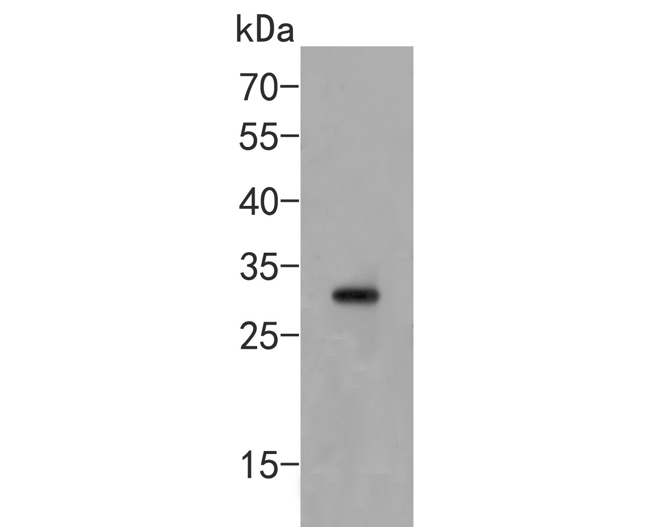 Western blot analysis of CLIC1 on mouse kidney tissue lysate. Proteins were transferred to a PVDF membrane and blocked with 5% BSA in PBS for 1 hour at room temperature. The primary antibody (ER2001-32, 1/500) was used in 5% BSA at room temperature for 2 hours. Goat Anti-Rabbit IgG - HRP Secondary Antibody (HA1001) at 1:5,000 dilution was used for 1 hour at room temperature.