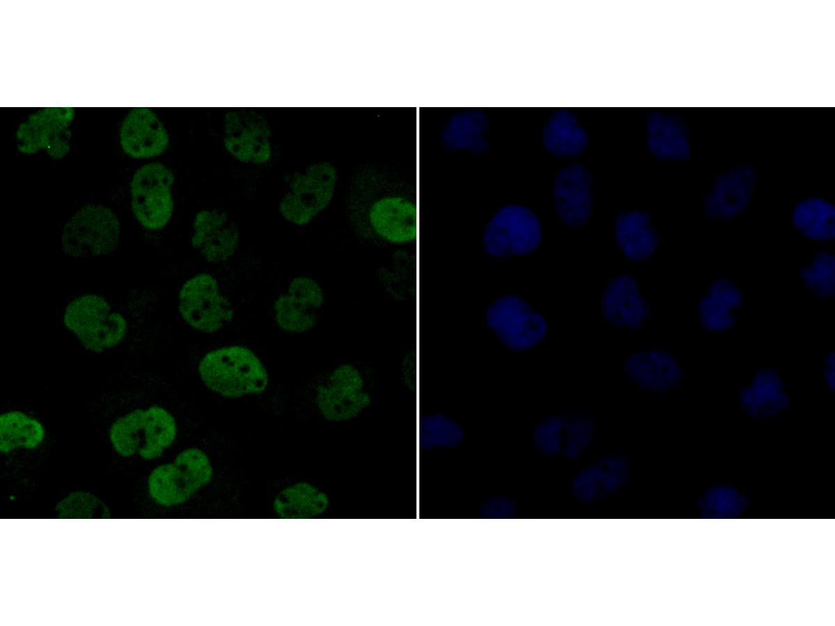 ICC staining CLIC1 in A431 cells (green). Formalin fixed cells were permeabilized with 0.1% Triton X-100 in TBS for 10 minutes at room temperature and blocked with 1% Blocker BSA for 15 minutes at room temperature. Cells were probed with CLIC1 polyclonal antibody at a dilution of 1:200 for at least 1 hour at room temperature, washed with PBS. Alexa Fluorc™ 488 Goat anti-Rabbit IgG was used as the secondary antibody at 1/100 dilution. The nuclear counter stain is DAPI (blue).