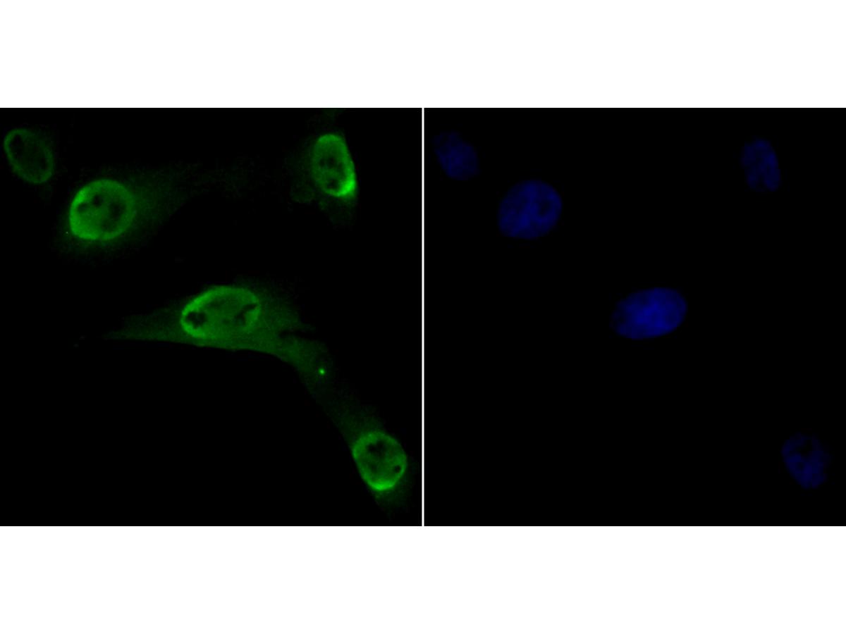 ICC staining CLIC1 in MG-63 cells (green). Formalin fixed cells were permeabilized with 0.1% Triton X-100 in TBS for 10 minutes at room temperature and blocked with 1% Blocker BSA for 15 minutes at room temperature. Cells were probed with CLIC1 polyclonal antibody at a dilution of 1:200 for at least 1 hour at room temperature, washed with PBS. Alexa Fluorc™ 488 Goat anti-Rabbit IgG was used as the secondary antibody at 1/100 dilution. The nuclear counter stain is DAPI (blue).
